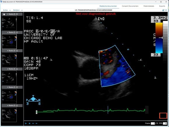Card Echo XDS (1)