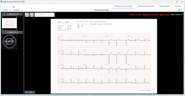 ECG XDS (1)