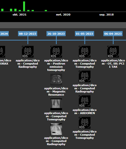 AGFA XDS Timeline