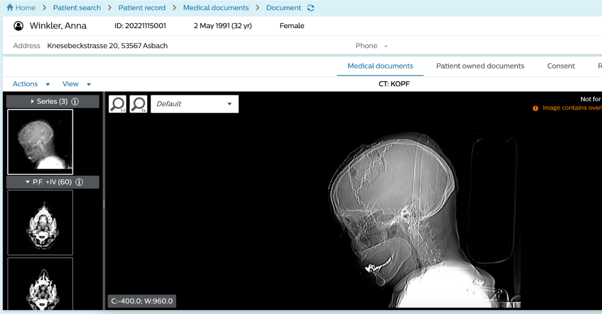 Retrieving DICOM Studies via XDS(-I)